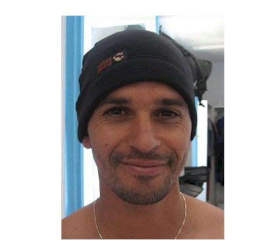 Weezle Extreme Skin Beanie Hat